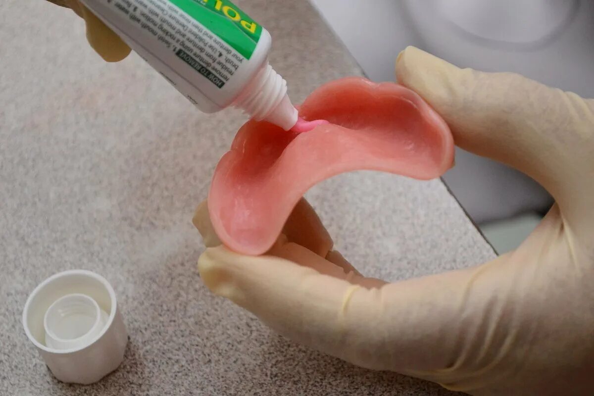 Как правильно наносить корегу на протез. Стоматологический клей для протезов. Клиническая перебазировка протезов. Клей для фиксации зубных протезов. Клей для склейки зубных протезов.
