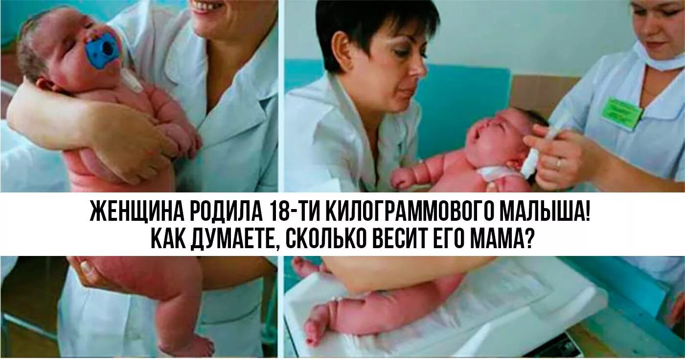 Женщина родился 18. Женщина родила 18 килограммового ребенка.