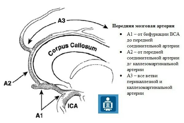 Сегмент а1 пма. Сегмент а1 передней мозговой артерии схема. М2 сегмент средней мозговой артерии. Сегменты средней мозговой артерии схема. М1 м2 ветви средней мозговой артерии.