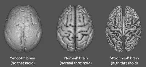 I my brains