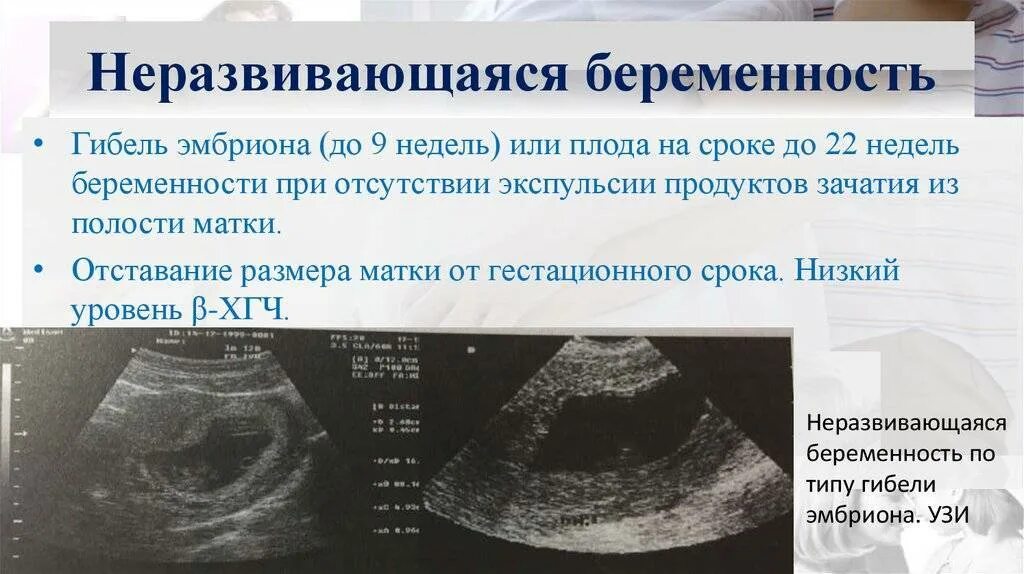 Узи беременность какой неделя можно. УЗИ признаки неразвивающейся беременности. Вымершая беременности. Не развивающая беременность.