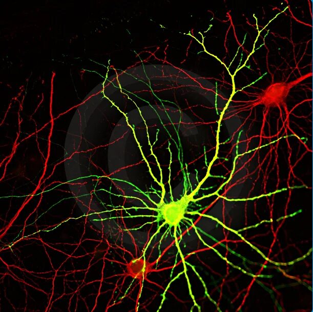 Neuro net. Neuro net