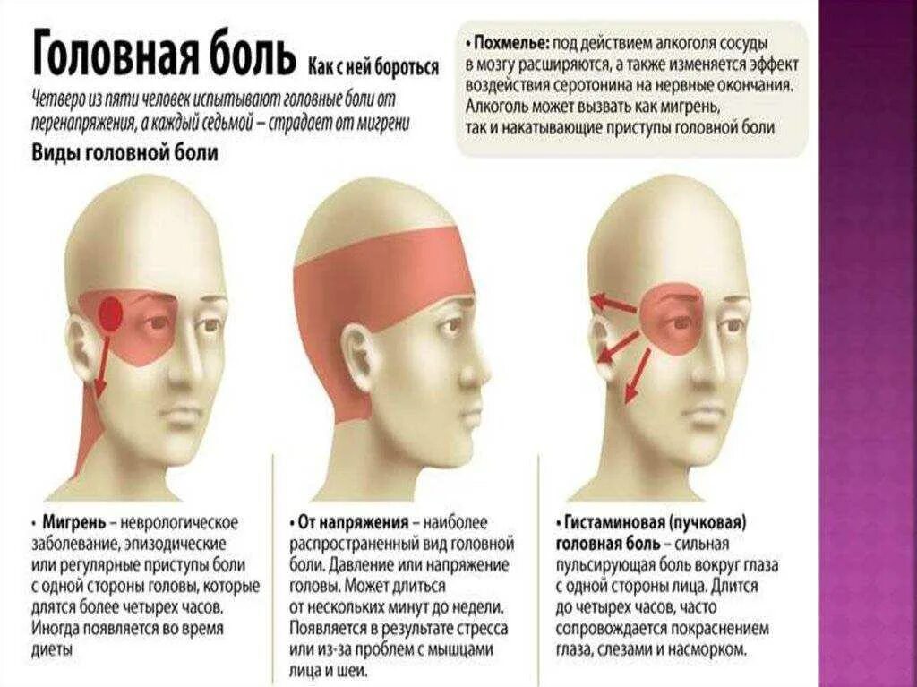 После спинального болит голова. Головная боль. Боль в голове. Болит голова и глаза. Головная боль локализация.