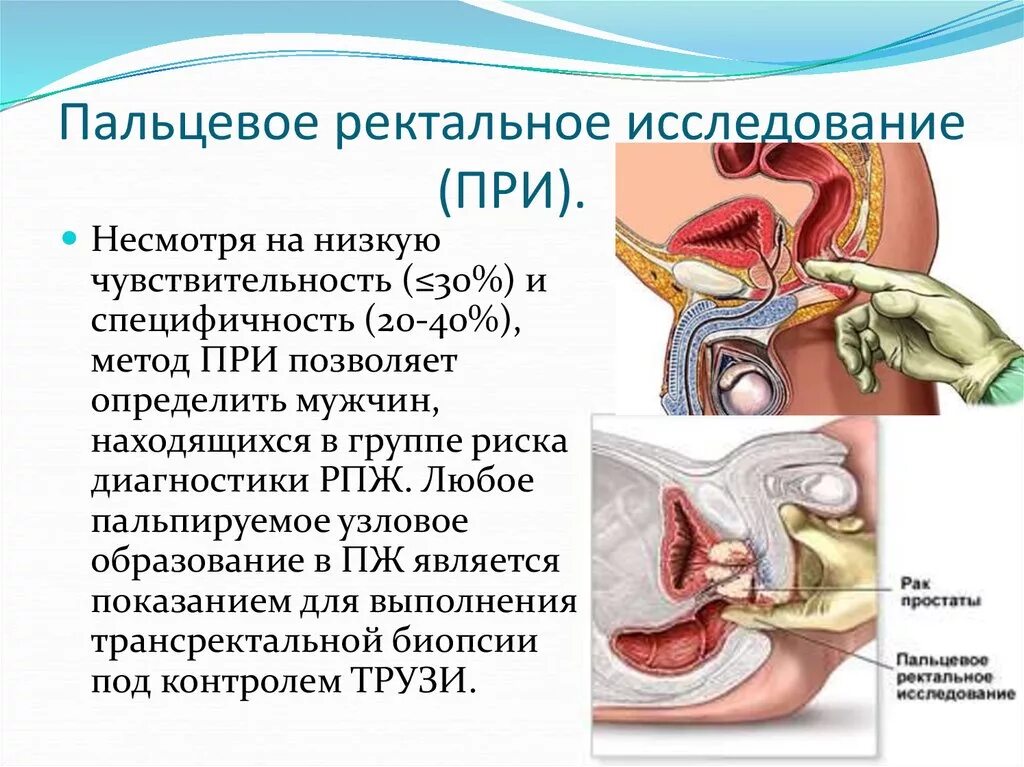 Ректальный анализ