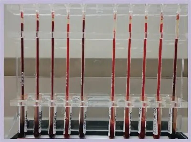 Соэ в крови по панченкову. Прибор Панченкова СОЭ. СОЭ капилляр Панченкова. Метод Панченкова СОЭ. Капилляр Панченкова норма СОЭ.