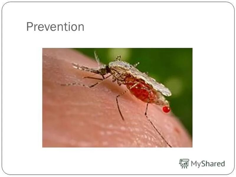 Малярией можно заразиться. Тропическая малярия фото. Малярия симптомы картинки. Тропическая малярия на латыни.