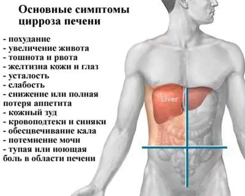 Болит печень увеличена. Симптомы цейрозы печени. Симптомы церозапечент. Если болит печень симптомы.