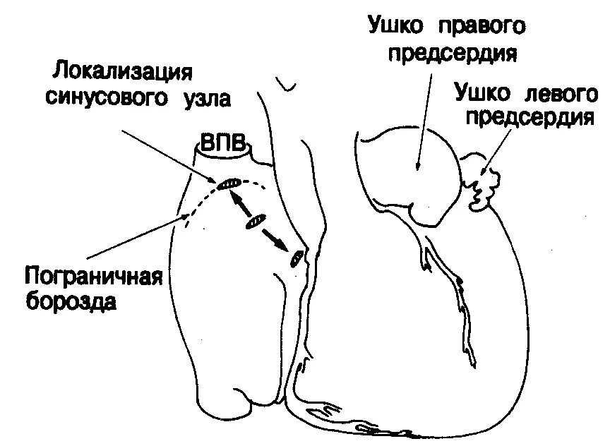 Тромбоз ушка левого предсердия. Окклюдер ушка левого предсердия. Сердечные ушки анатомия. Ушко правого предсердия анатомия. Ушко левого предсердия анатомия.