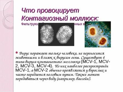 Как удалить моллюск