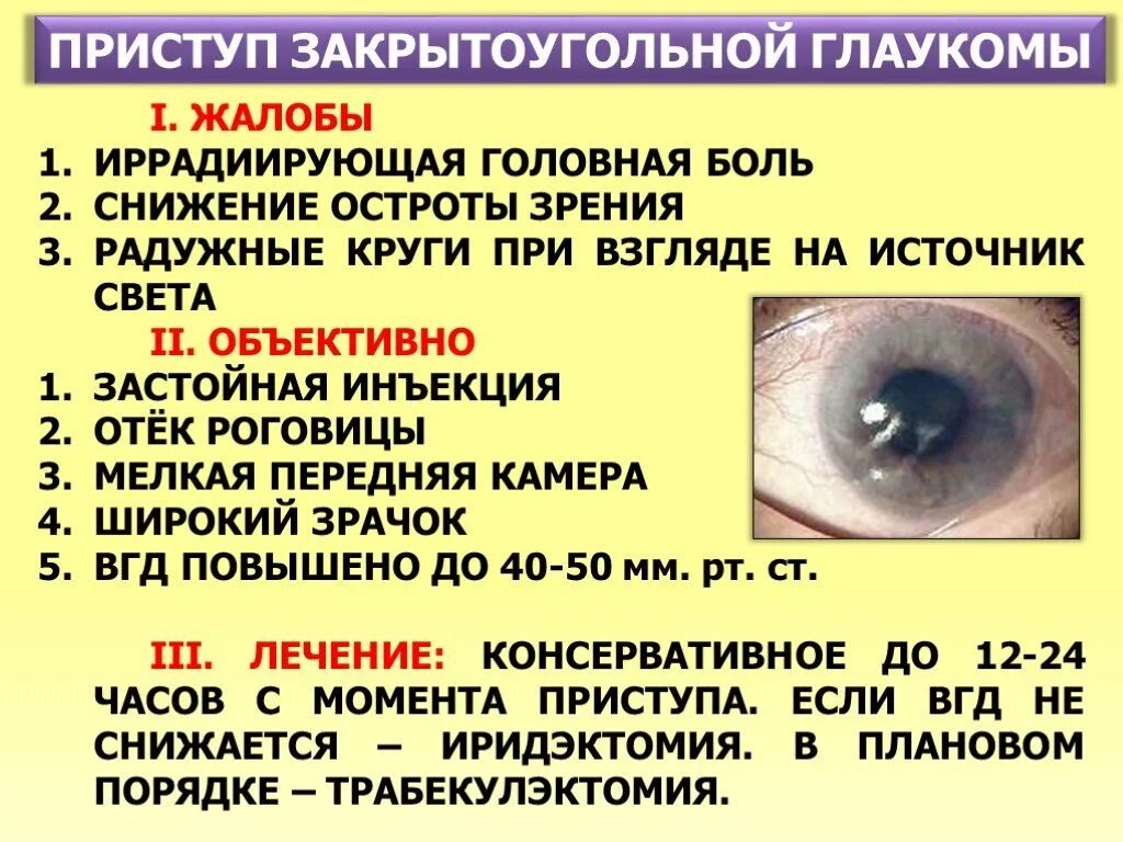 Как вылечить глаукому. Приступ открытоугольной глаукомы симптомы. Симптомы острого приступа закрытоугольной глаукомы. Острый приступ открытоугольной глаукомы. Закрытоугольная глаукома глаза.