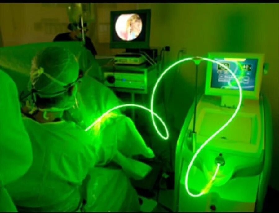 Лазерная операция по удалению простаты. Лазерная энуклеация предстательной железы. Лапароскопическая простатэктомия. Эндохирургическое оборудование. Гольмиевая лазерная энуклеация.