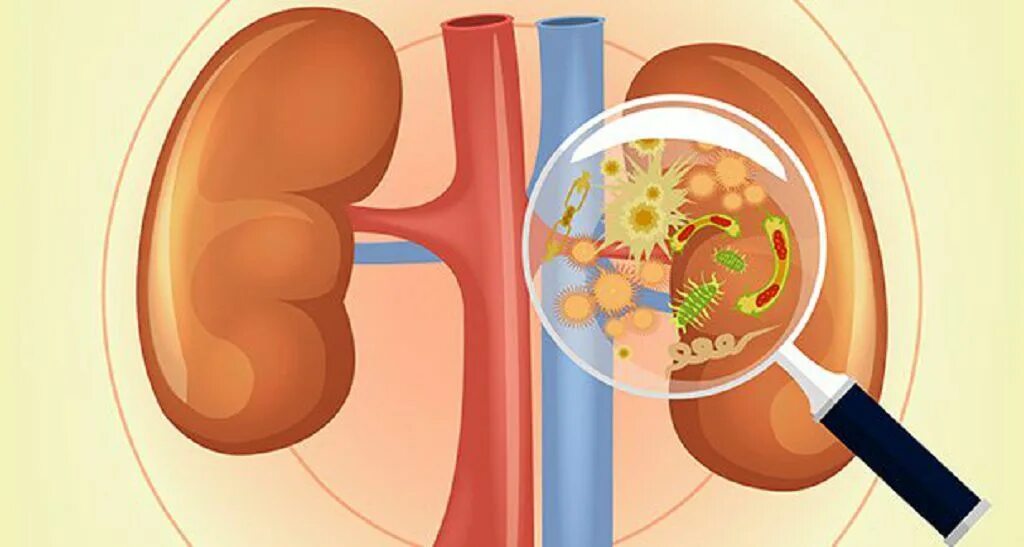 Белки при пиелонефрите. Здоровая и больная почка. Почки рисунок.