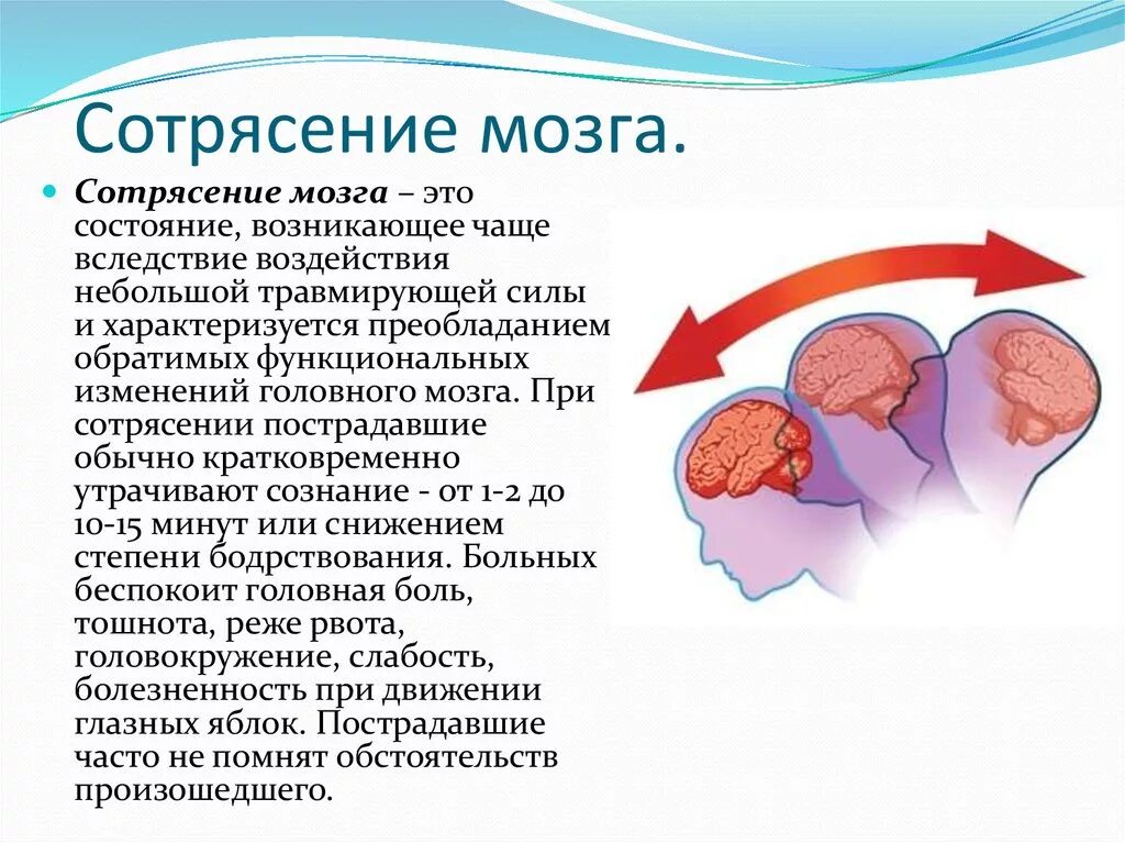 Сотрясение в домашних условиях. Сотрясение головного м. Сотрясение головного мозга симптомы.