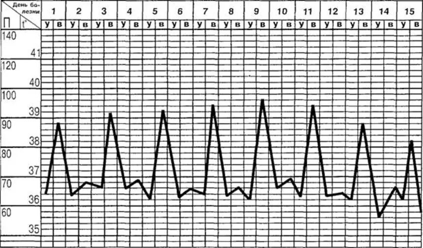 Температурный лист графическим. Температурный лист гектическая лихорадка. Интермиттирующая лихорадка температурный лист. Типы лихорадок на температурном листе. Типы лихорадка температурных.