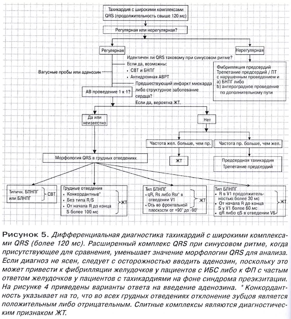 Суправентрикулярная тахикардия дифференциальная диагностика. Дифференциальный диагноз тахикардий с узкими комплексами. Тахикардия с широкими комплексами qrs. Широкий комплекс qrs. Супантривентикулярная тахикардия.