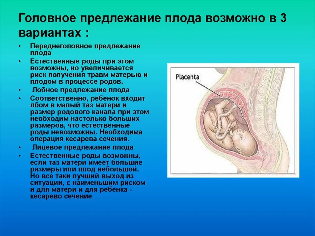 Предлежание плода 32 недели