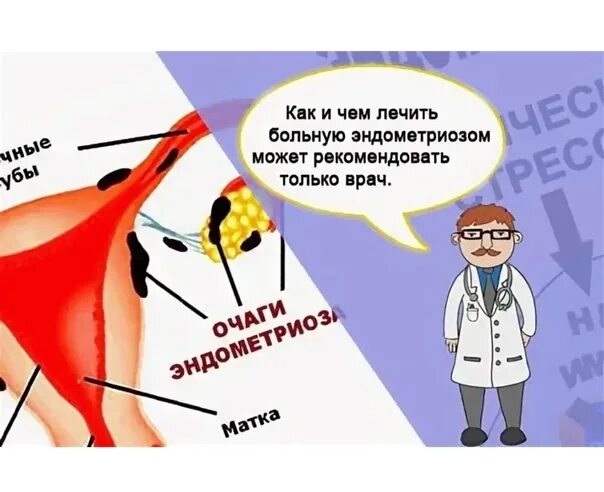 Эндометриоз презентация. Эндометриоз заболеваемость. Эндометриоз внешний и внутренний. Эндометриоз не лечится.