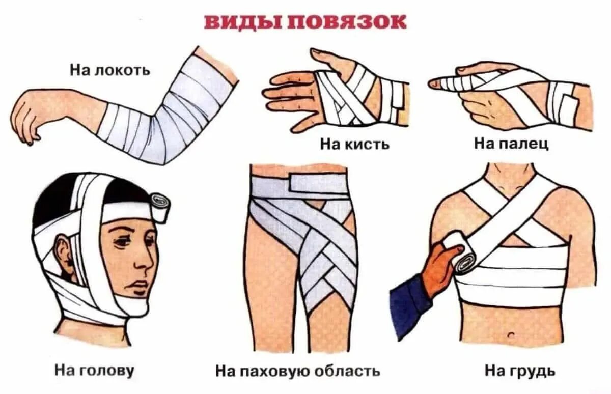 Десмургия повязки алгоритм. Техника наложения повязок видео. Правильное наложение повязки. Десмургия повязки. Техника бинтования десмургия.