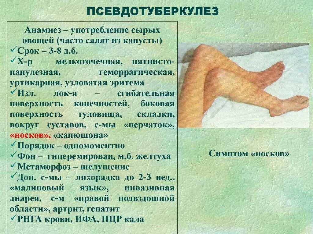 Температура боли в суставах сыпь. Спь при псевдо туберкулез. Псевдотуберкулез симптомы. Псевдотуберкулез клинические проявления.