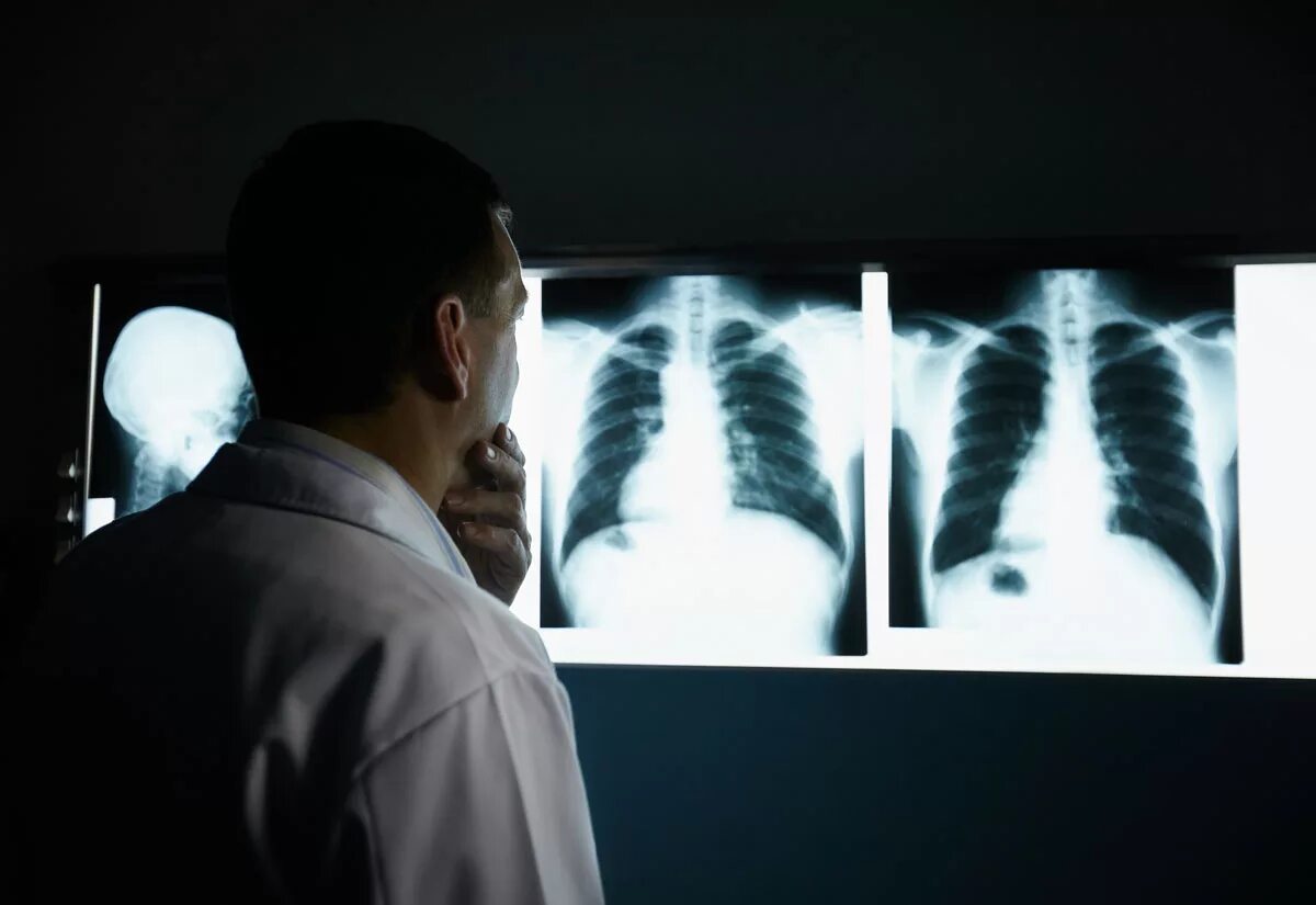 Легкие эксперты. Пульмонология легкие. Легкие эксперты. Легкие эксперты. Рентген легких.