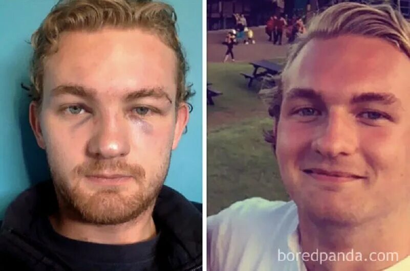 Изменился в лице когда понял. Пропитое лицо до и после. Лицо алкоголика до и после.