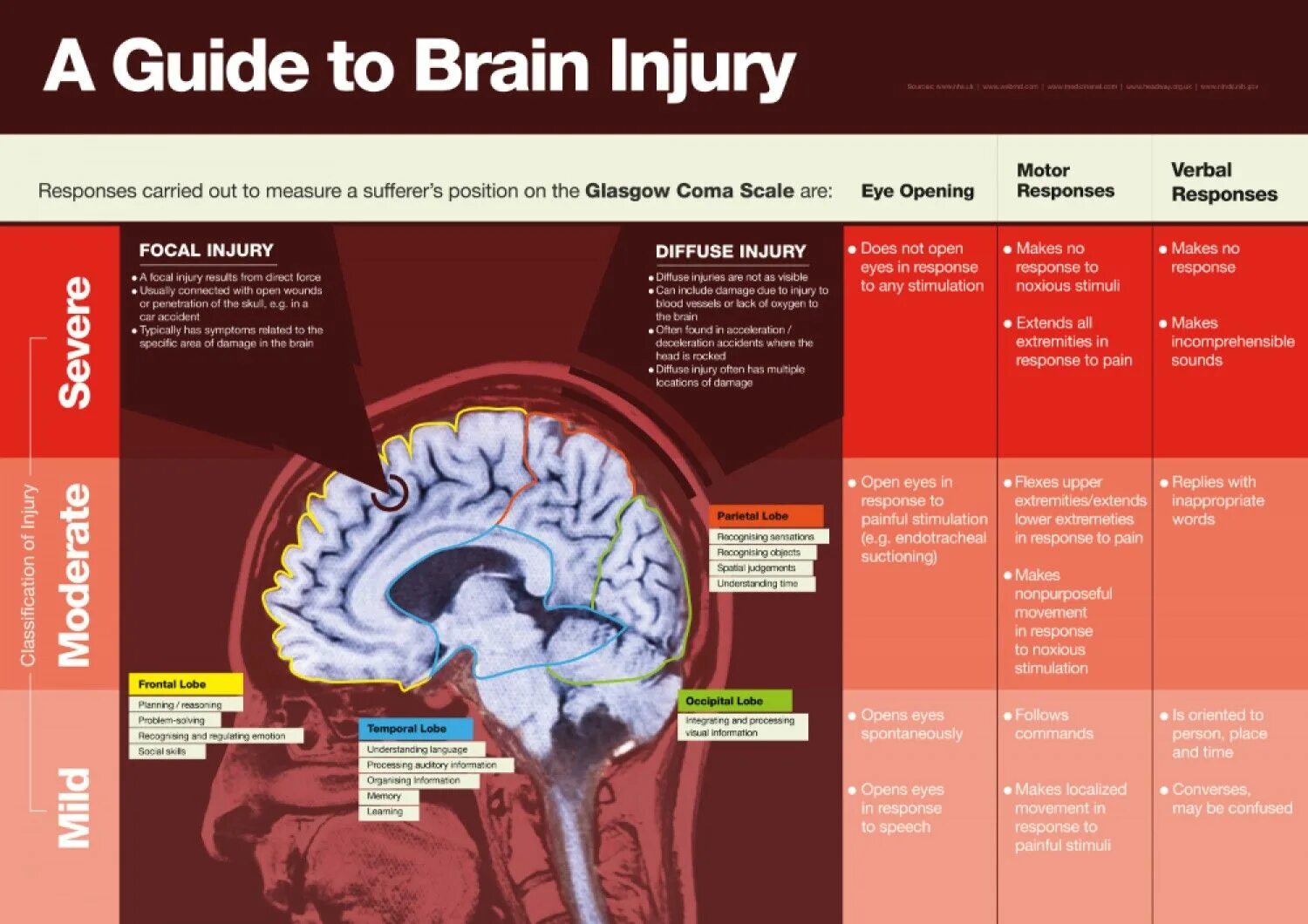 Brain injury. Traumatic Brain injury Symptoms.