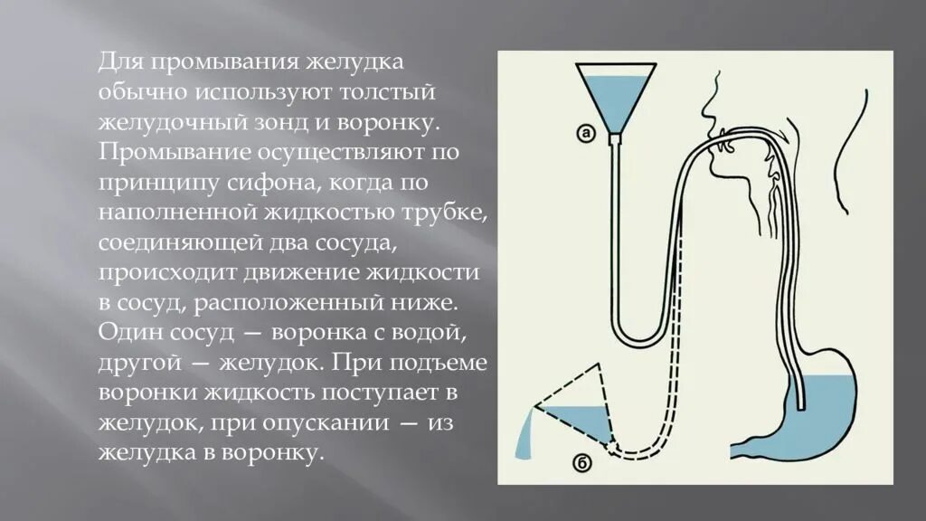 Установите правильную последовательность при промывании желудка. Для промывания желудка применяется зонд. сифонный метод промывания желудка. алгоритм беззондового промывания желудка. промывание с использованием толстого зонда.