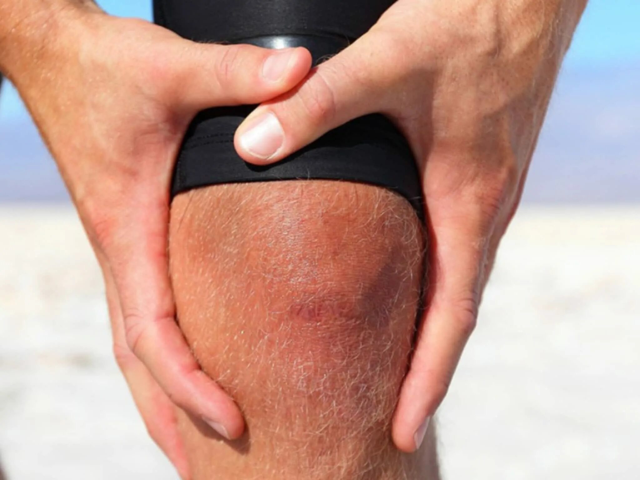 Боль в колене растяжение. Травма коленного сустава код