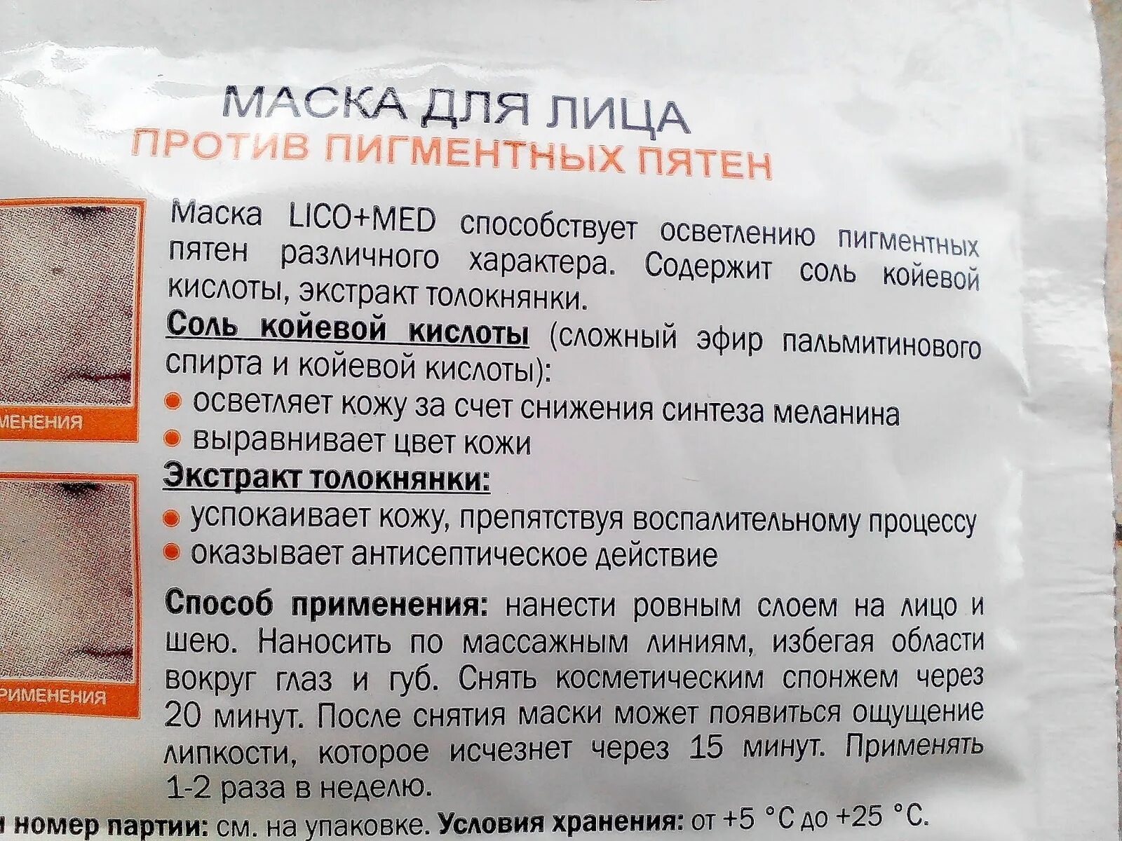 Маска против пигментации. Маска для лица от пигментных пятен. маска от пигментации на лице в домашних. рецепты от пигментных пятен на лице. койевая кислота от пигментных пятен.
