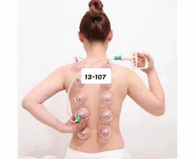 Можно Ставить Банки При Температуре - 61 Фотo