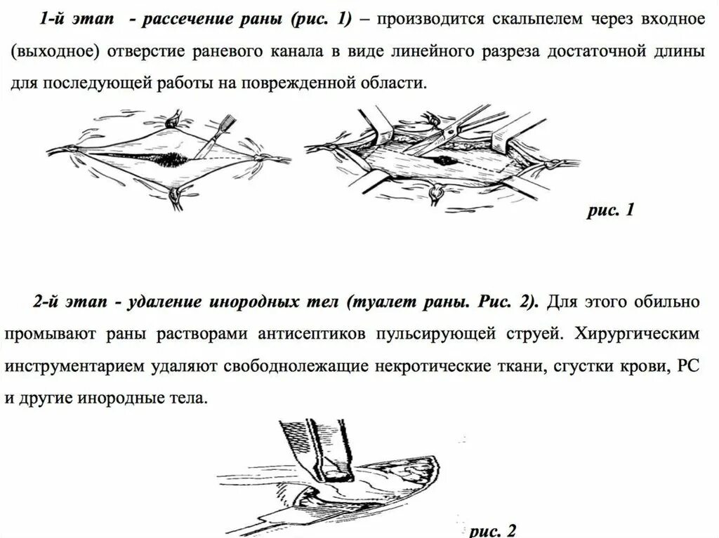 Этапы первичной хирургической обработки огнестрельной раны. Первичная хирургическая обработка огнестрельных РАН. Пхо при огнестрельных ранах. Книга рассечение стоуна