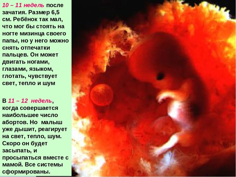 Плод на 10 неделе беременности. Размер эмбриона в 10 недель. Почему на 10 неделе беременности