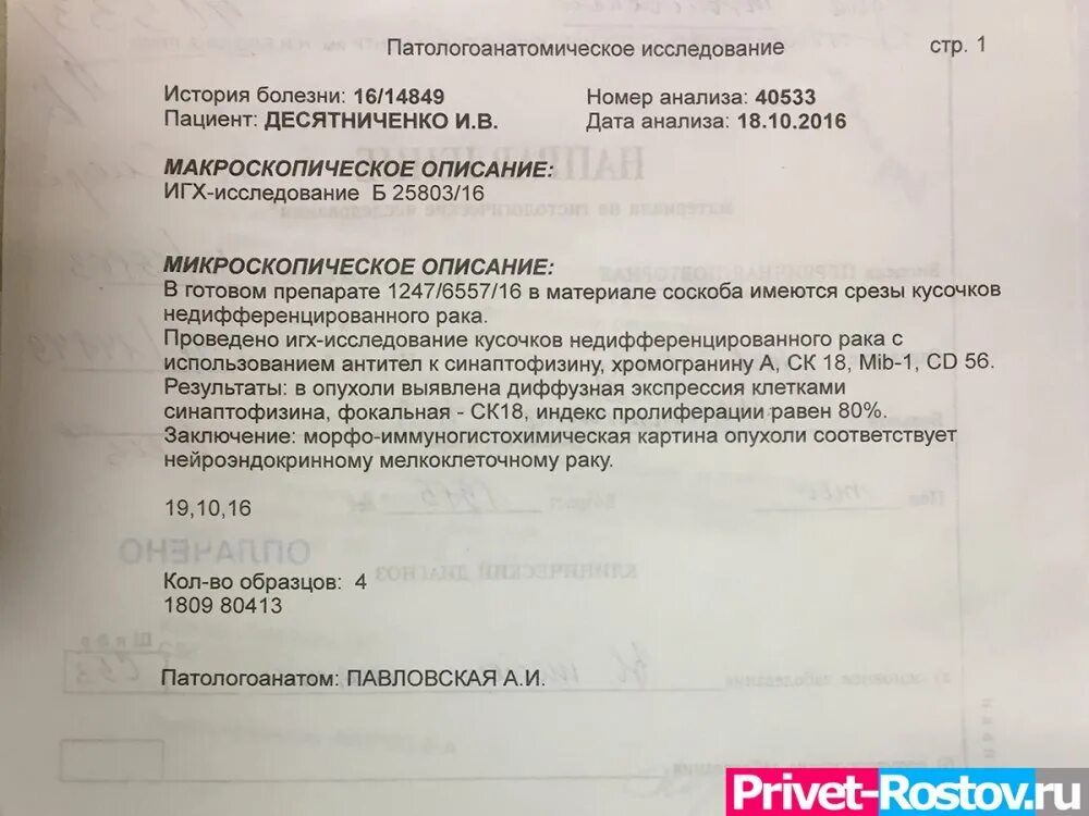 Диагнозы в онкологическом отделении. Гистологическое исследование молочной железы биопсийный материал. Гистология опухоли заключение. Биопсия молочной железы заключение. Гистологические исследование молочной железы заключение биопсии.