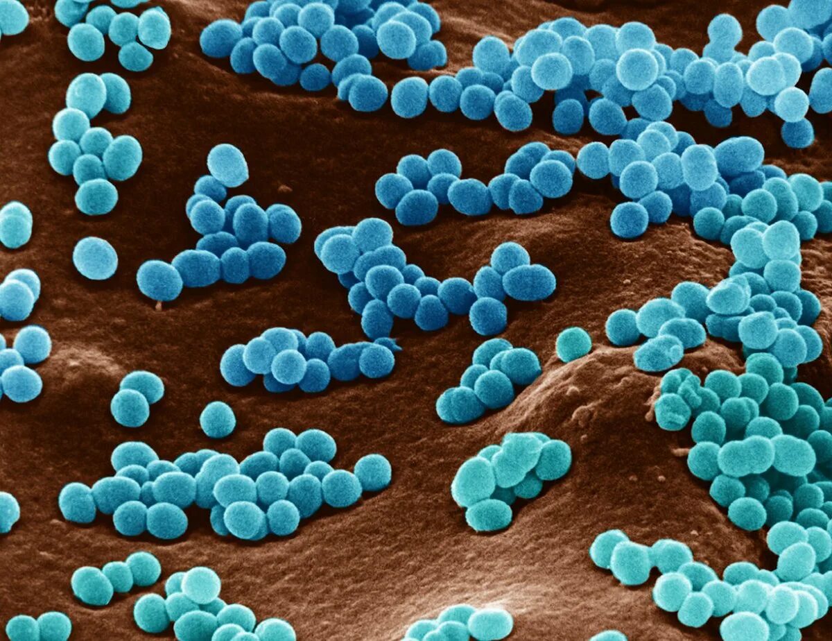 Бактерии округлой формы. Кокки микрококки. Шарообразные кокки бактерии. Шаровидные бактерии микрококки. Шаровидные бактерии кокки.