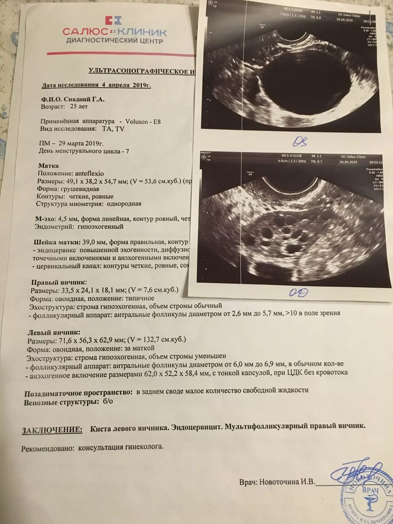 Киста желтого тела УЗИ заключение. Киста желтого тела на УЗИ протокол. Заключение киста желтого тела левого яичника. Заключение УЗИ при кисте яичника. Можно перепутать беременность с кистой