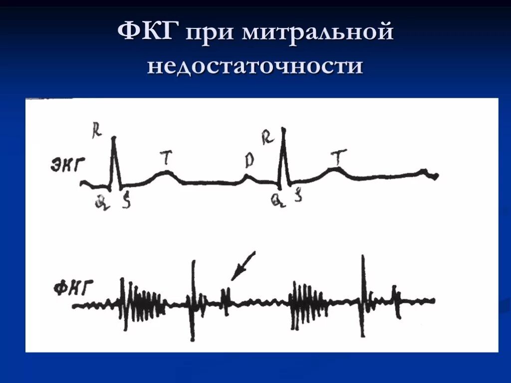 Графическое изображение фкг