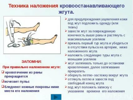 Признаки правильно наложенного жгута тест