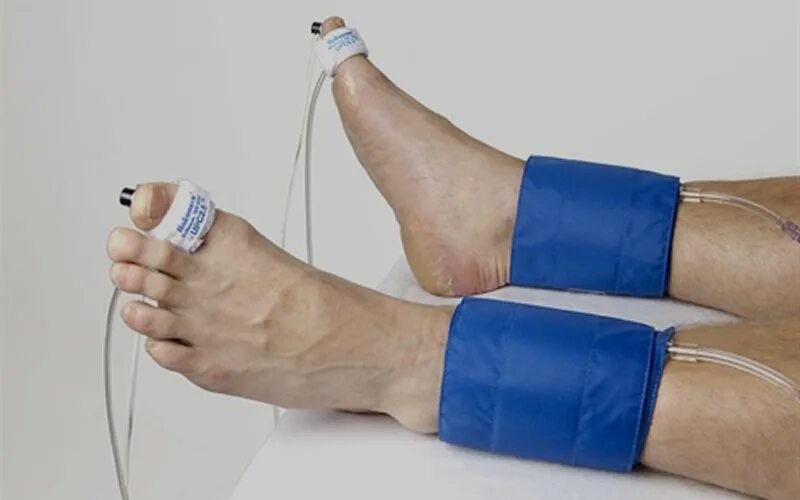 Foot test. Монофиламент 10. Типы пальцев на ногах. Монофиламент для диагностики диабетической нейропатии. Overpronator перевод.