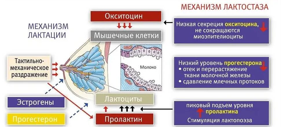 Застой молока при грудном вскармливании с температурой