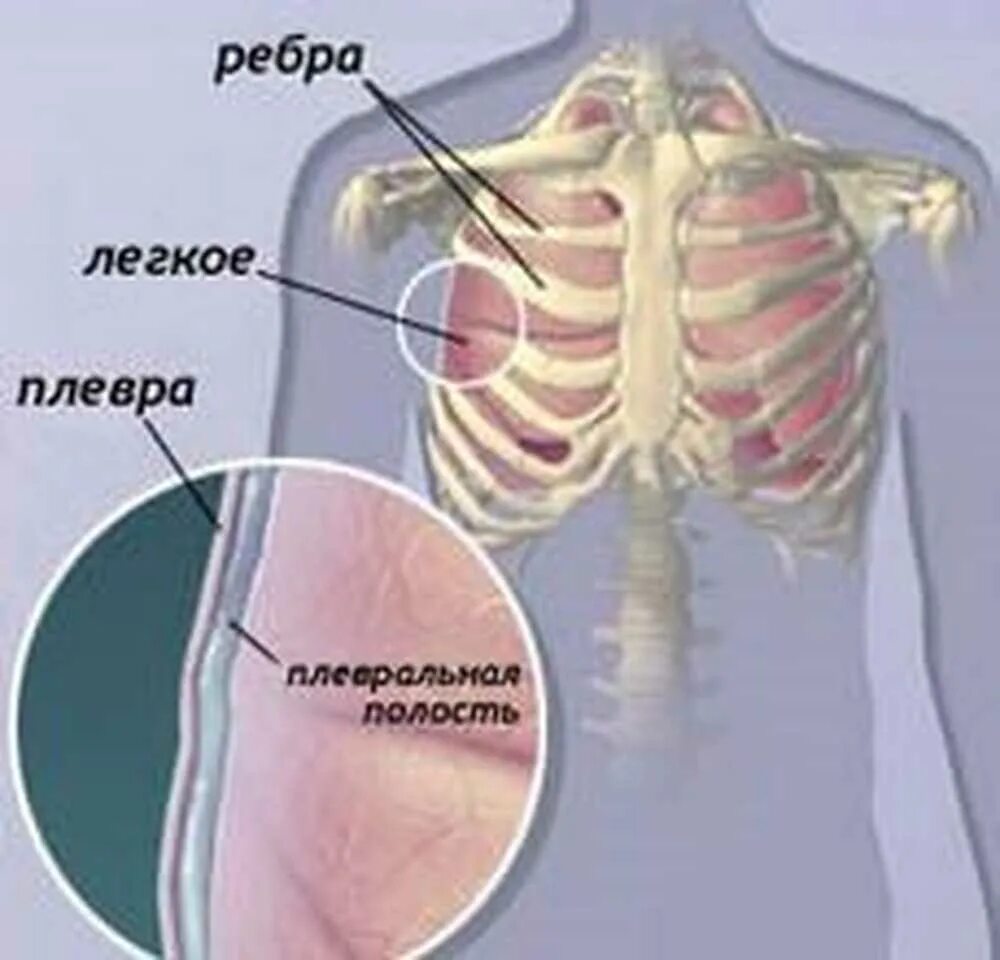 Плевральная полость анатомия. Плевральная полость лёгкого. Легкие и плевральная полость. Плевра и плевральная полость.