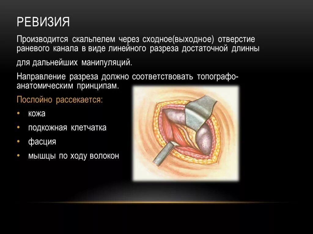 Ревизии ран