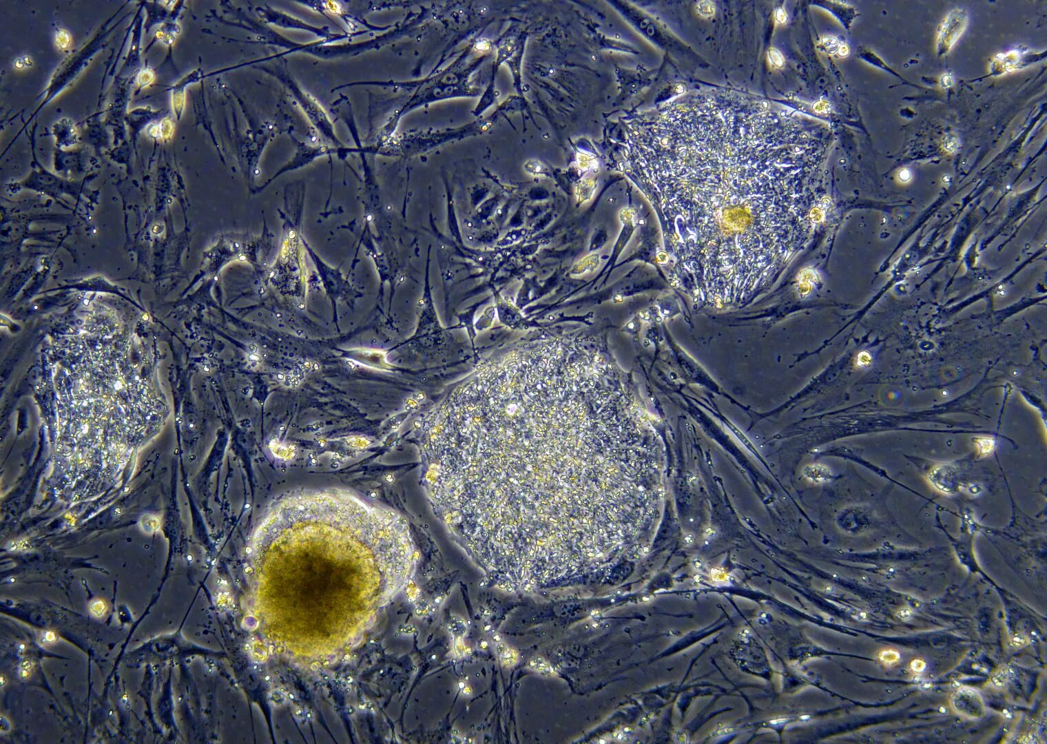 Эмбриональные стволовые клетки под микроскопом. Фетальная стволовая клетка. Фетальные стволовые клетки под микроскопом. Кроветворные стволовые клетки под микроскопом.