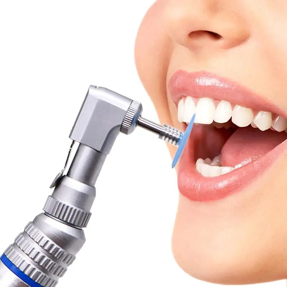 Чистка полировка зубов