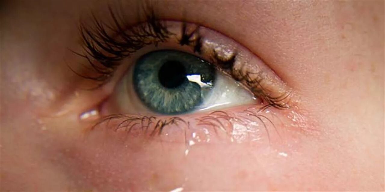 Слезотечение из глаз причины у взрослых. Обильное слезотечение.