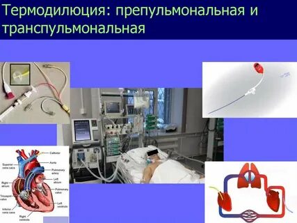 Инвазивная гемодинамика