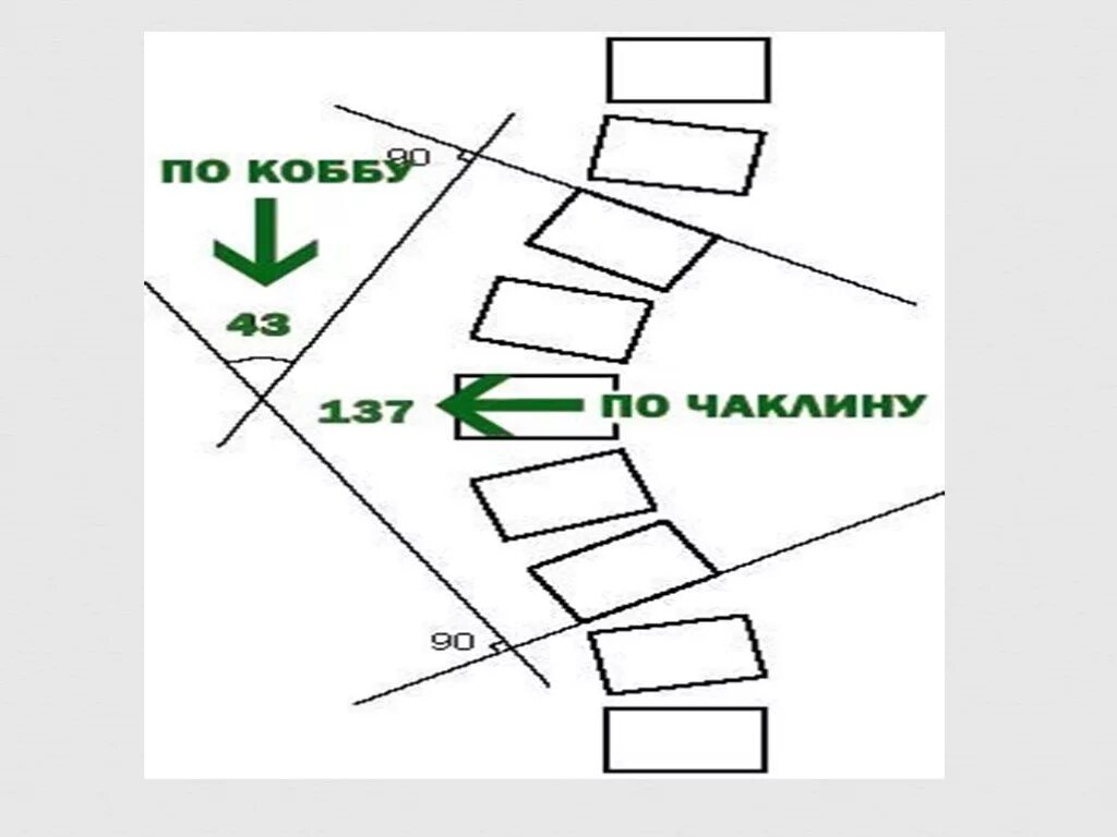 Угол Кобба степени сколиоза. Классификация сколиоза по чаклину и коббу. Классификация сколиоза по чаклину рентген. Угол Кобба и Чаклина. Угол кобба