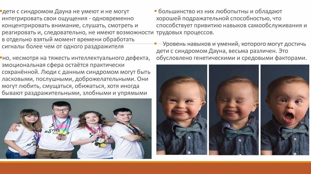 Младенцы с синдромом Дауна. Дети людей с синдромом Дауна. Украина дауны