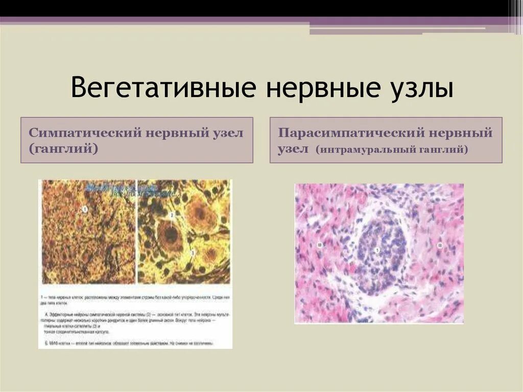 Строение нервного узла. Строение ганглия гистология. Вегетативный узел препарат. Симпатический ганглий гистология препарат. Экстрамуральный симпатический ганглий гистология.