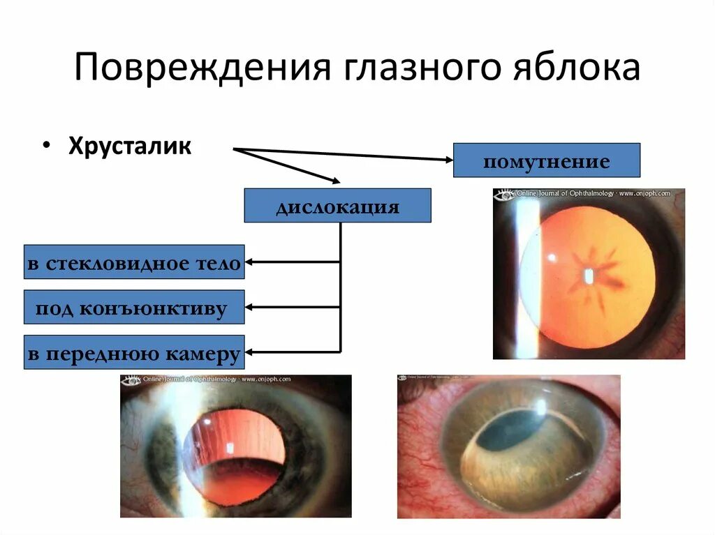 Как следует поступать при травме глазного