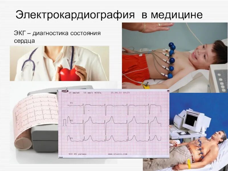 Электрокардиография. Электрокардиография (ЭКГ). Что такое ЭКГ В медицине. ЭКГ на человеке. Компьютерный экг